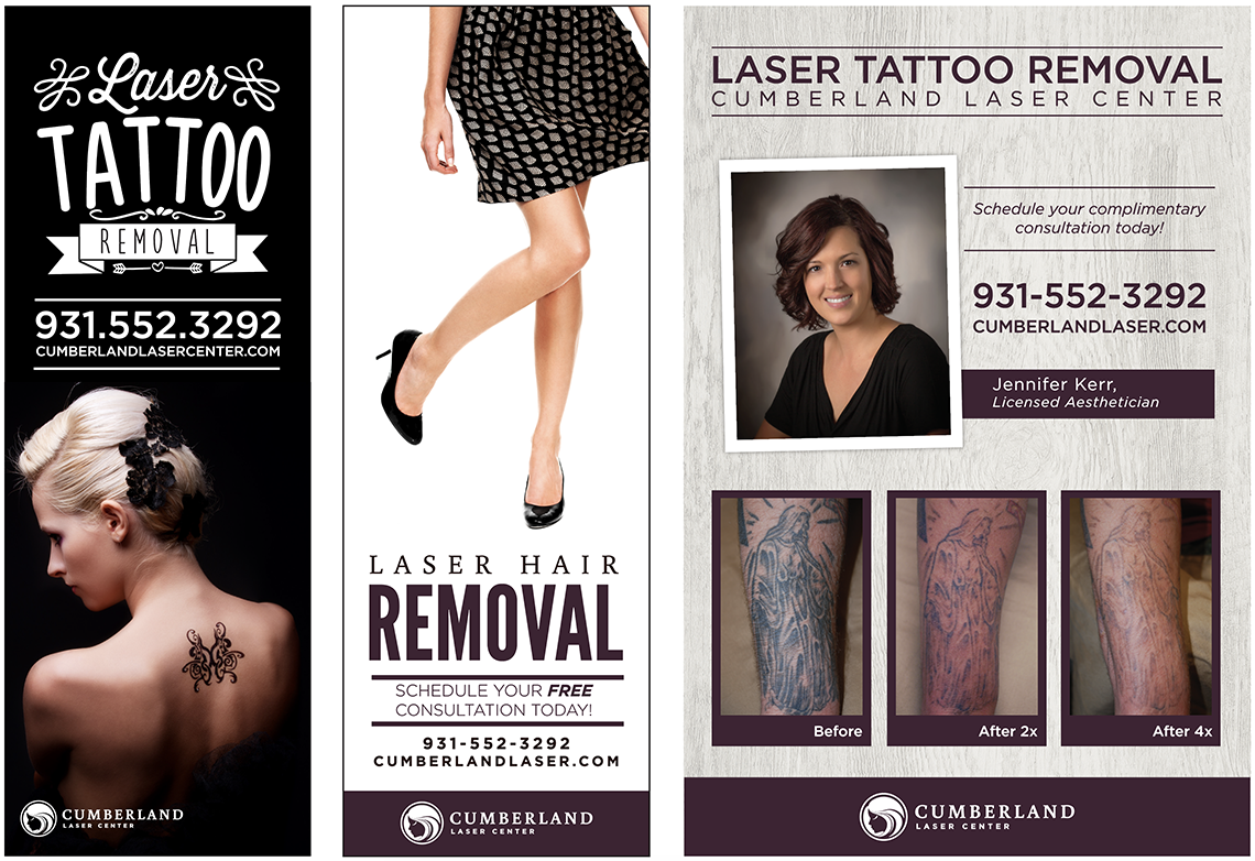 A Change Of Art Laser Tattoo Removal (@achangeofartltr) / X